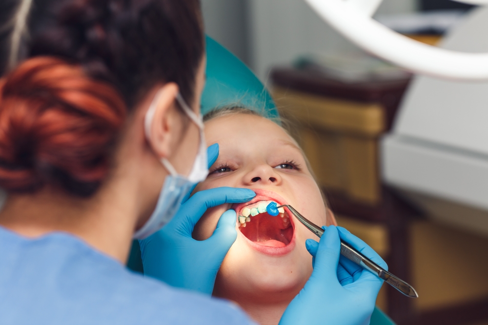 Fluoride Treatments