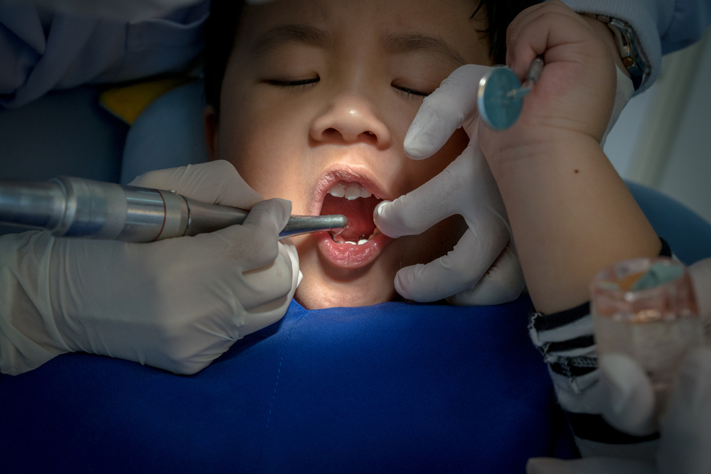 Fluoride Treatments