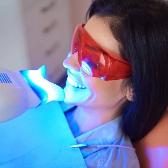 professional teeth whitening in Chatham