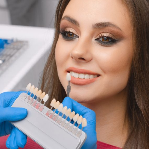 Veneers